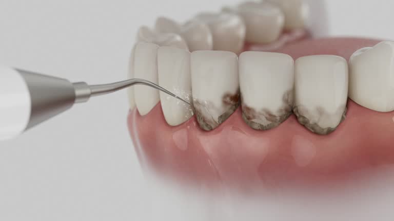 Reliable Wisdom Tooth Removal contractor in Macon County County, TN by Dentist Open Now